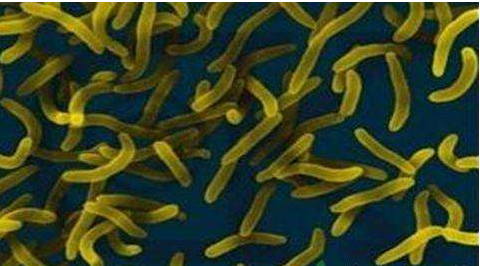 微生物菌劑好？好在哪里您知道嗎？